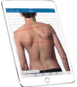 Posture diagnosis screen on tablet