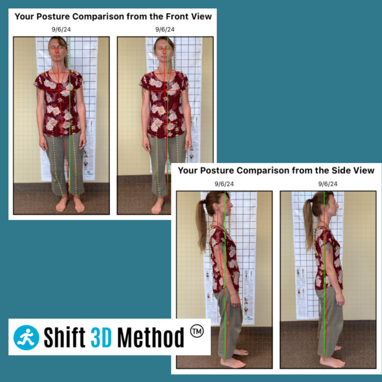 Before and after photos with New Client Shift 3D Method Assessment and Treatment on massage table